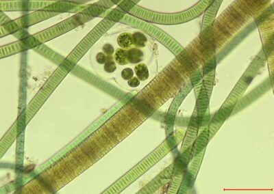 amas de cyanobactéries filamenteuses issu d'un floc